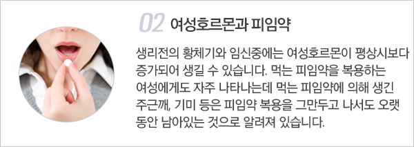 주근깨 / 잡티의 원인 이미지2