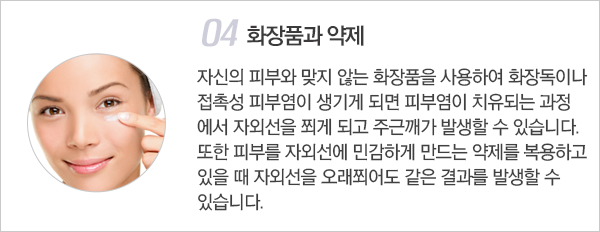 주근깨 / 잡티의 원인 이미지4